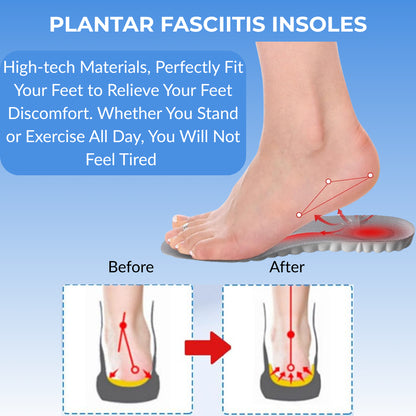 Stepwise™ CloudForm Insoles